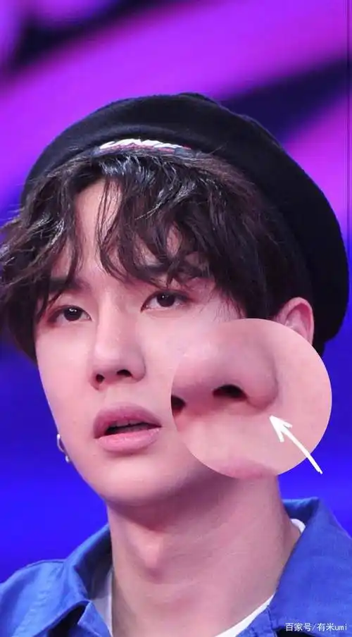 王一博新剧开播,网友却又盯上了他透光的鼻子?_整形_鼻梁_鼻头