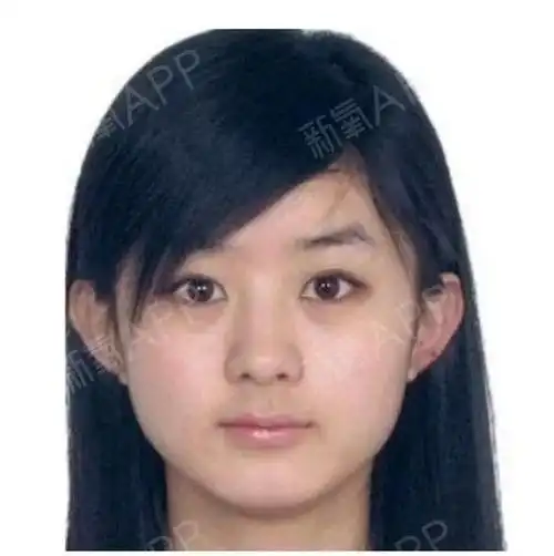 赵丽颖本身是有双眼皮的,眼距比较宽,眼尾也是微微上扬的,但是本身的