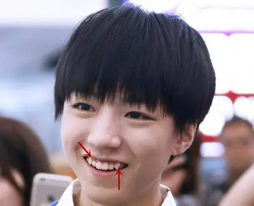 新剧《安家》女主孙俪自曝曾做牙齿矫正