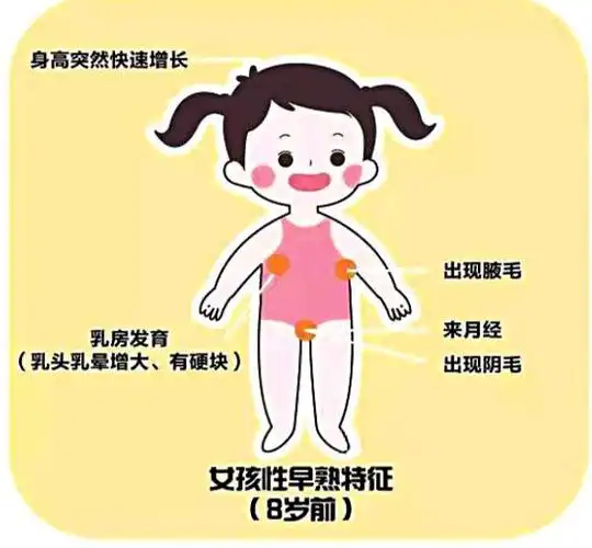 性早熟"找上"6岁女童 这些误区一定要提前知道
