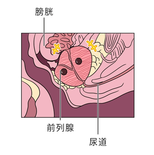 裤子脱了趴下去医院里让人脸红的男性检查一个比一个尴尬