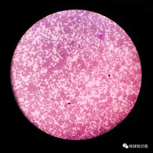 (图:shutterstock)▼显微镜下的红细胞凝集,透着点诡异1900年,奥地利