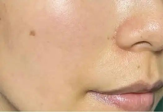 肌肤暗沉发黄?这里有你需要的提亮秘诀!