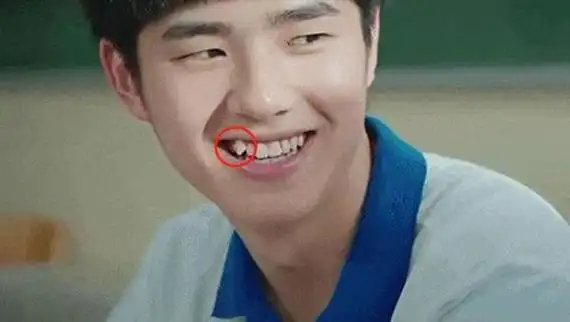 孩子的虎牙要不要拔掉 孩子矫正牙齿的最佳年级