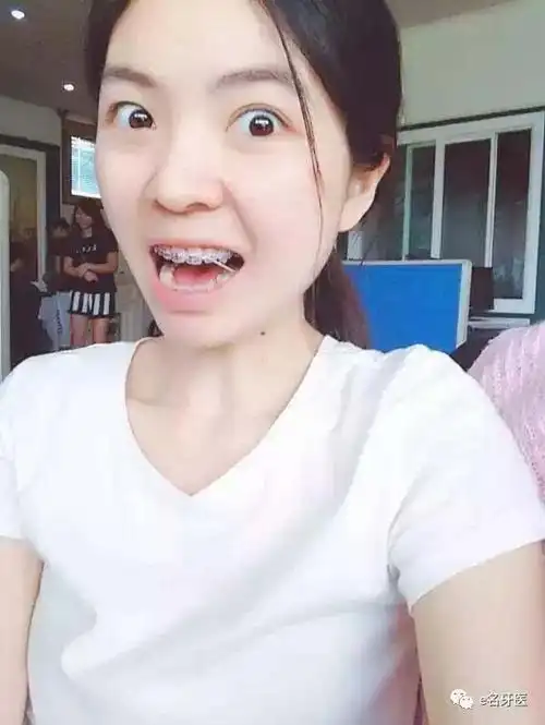 有虎牙是一种怎样的体验?