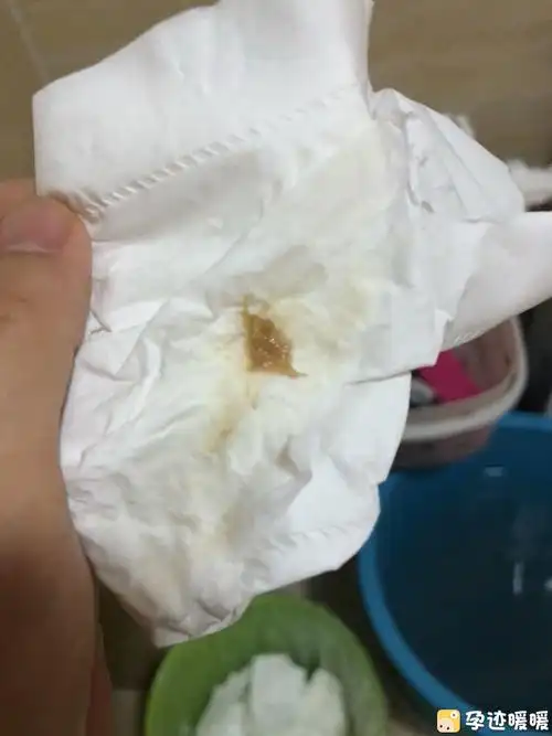 姐妹们这是褐色分泌物么?求解答