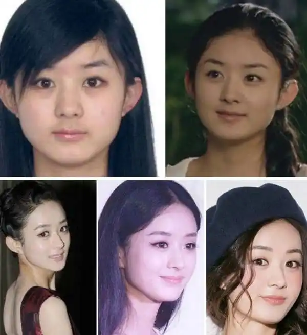 赵丽颖早期颜值巅 你还在怀疑她整容了吗?