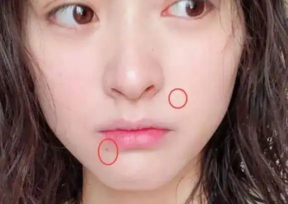 嘴角有痔:位置不同,命运迥异,解析嘴边痣的吉凶寓意