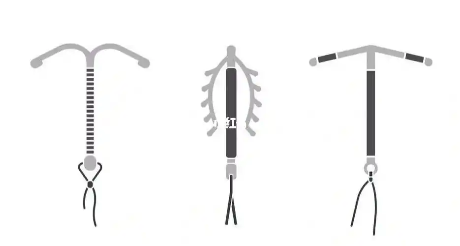 节育环也有寿命到期记得取