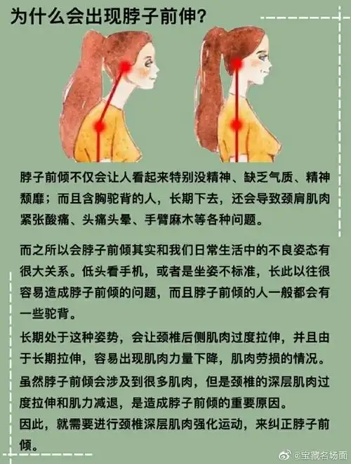 如何通过锻炼改善脖子前倾