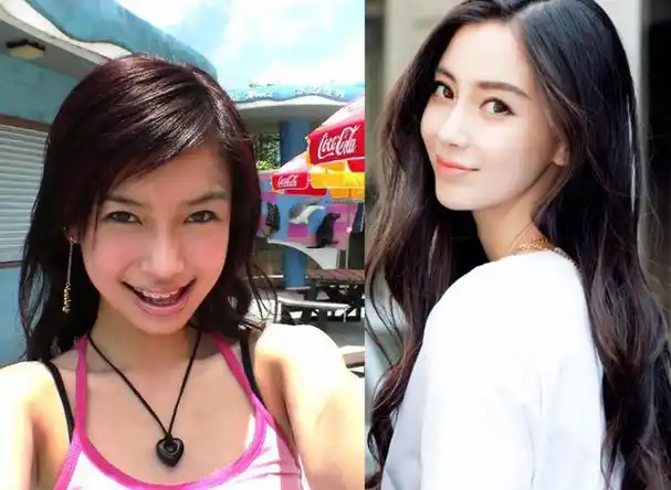 整容痕迹明显的几位女明星,却"死活"不承认自己做过整形