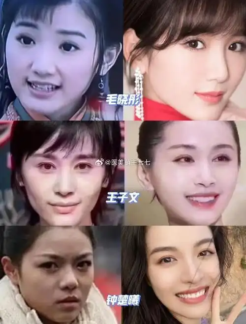 爱美之心人皆有之,但整容需谨慎,有太多整容失败的例子了,整商是关键