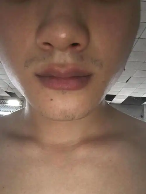 人中没有胡须或胡须少是什么意思胡须稀少怎么办