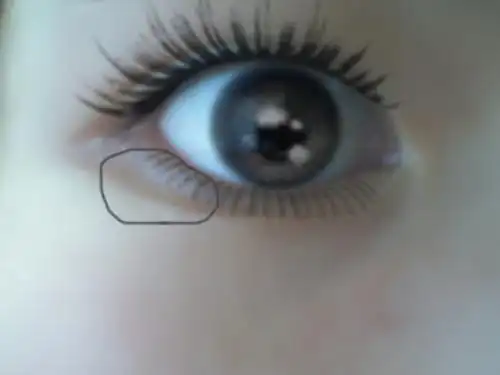 眼睑在哪(有图)