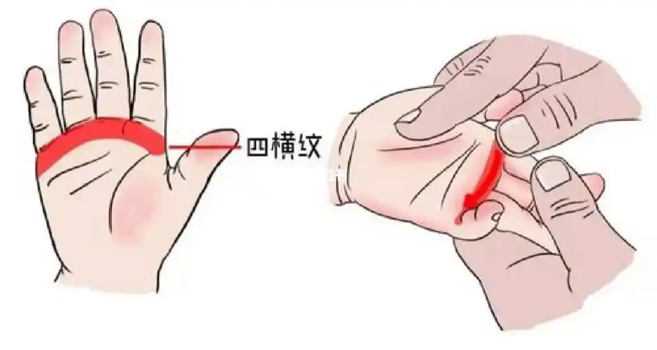 在穴位上作直线推动称为推法,四横纹穴为改善积食等问题的要穴
