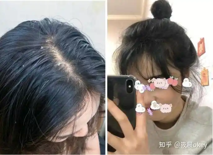 油性发质,而且掉头发,一般一天洗一次头发,用什么洗发水比较好?