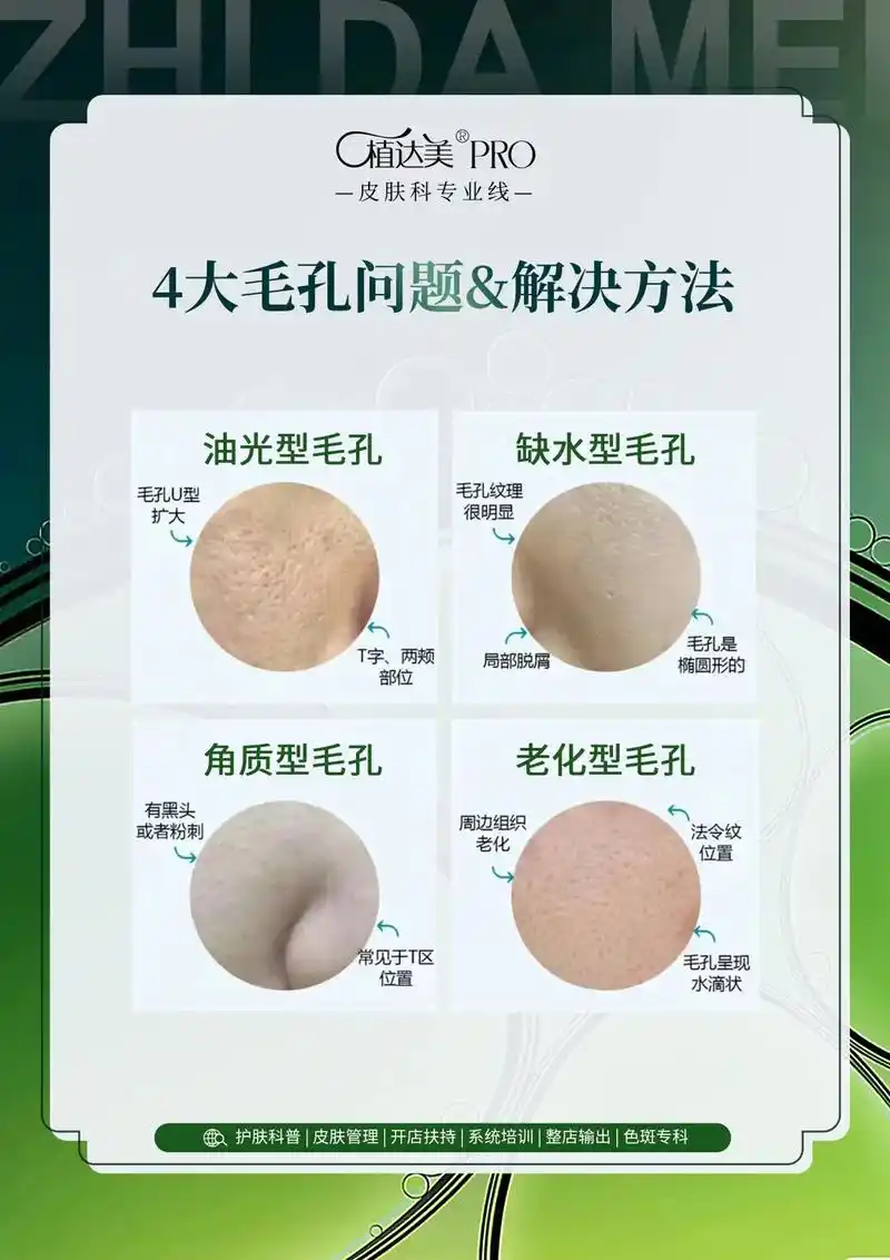 四中毛孔粗大类型|1分钟教你如何收缩毛孔.毛孔粗大是一众爱美 - 抖音