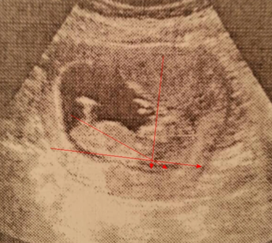 欢快!3个亮点是男孩"传宗接代"-第1张图片-华泰博客