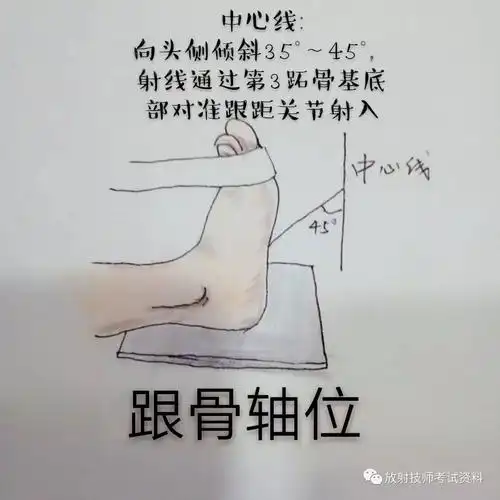 【实习生手记】摄影体位之跟骨侧轴位