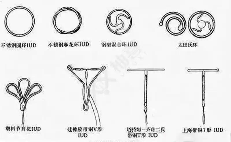 节育环又叫节育器是一种放置在子宫腔内的避孕装置,节育环的种类有