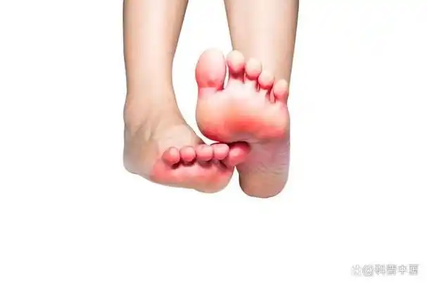 每天起床脚掌一着地就疼得不行,这是怎么回事?