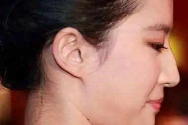 山根是哪里没有山根的鼻子图片