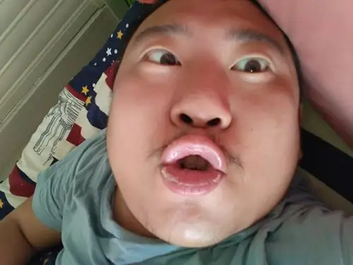 重庆现网红"拱嘴哥"靠恶心卖萌吸粉丝上亿 直接秒杀快手嘟嘟姐