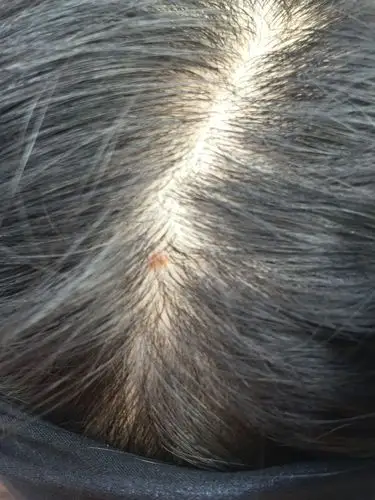 头皮上红色的点不知道是什么东西