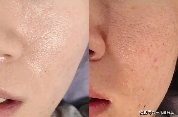 换季皮肤护理小贴士~_肌肤_问题_护肤品