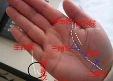 手相生命线若出现三角纹,十字纹,定有大病!
