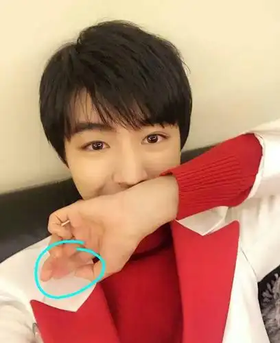 王俊凯的手受伤一个月还未痊愈,恐将留下伤痕