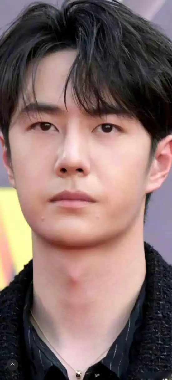 王一博长痘了##王一博的痘痘好对称#王一博有点子可爱,长痘痘了都是