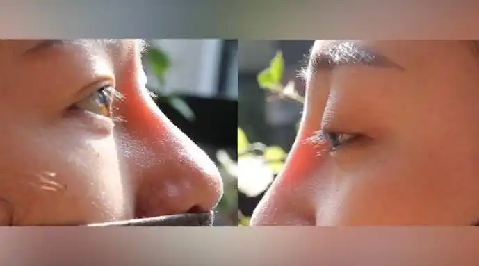 澎湃315调查 |透光的鼻子,无证的医生,租来的手术室