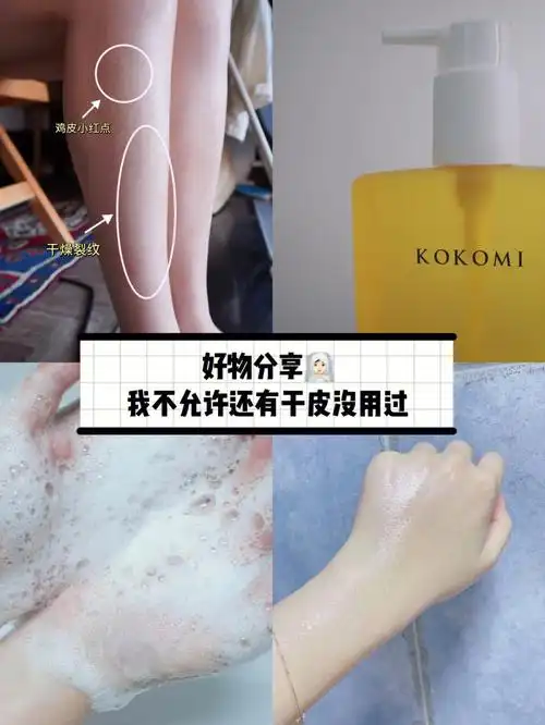 腿都会起皮的人08秋冬就会又干又痒~沐浴油这个东西,干皮的我一用就