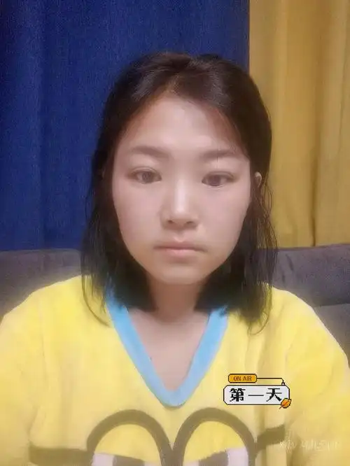 滤镜,为了看的清楚,特意穿同一件衣服,哈哈哈,我感觉我这两天脸紧绷了