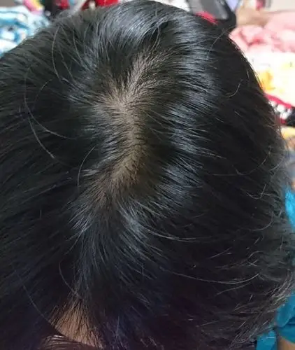 groot养发秘帖,天然顶级草本配方-发根强健