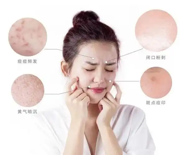 肤色暗沉自救指南一天几毛钱改善发黄熬夜肌