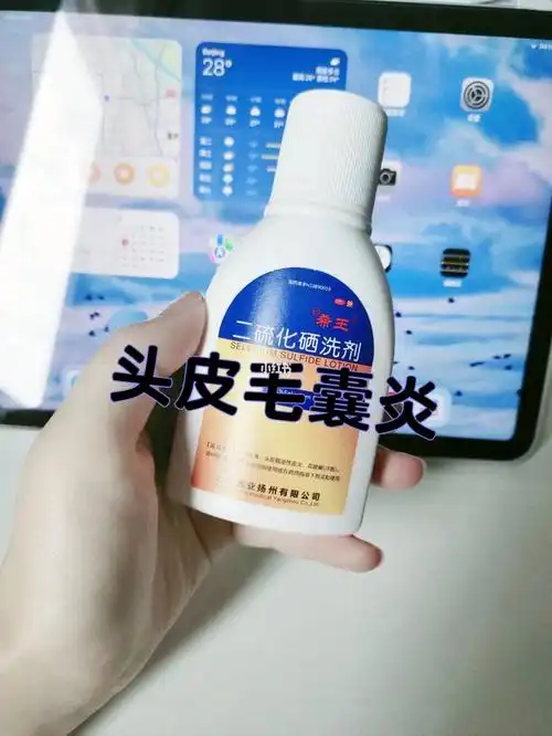 头皮毛囊炎看进来