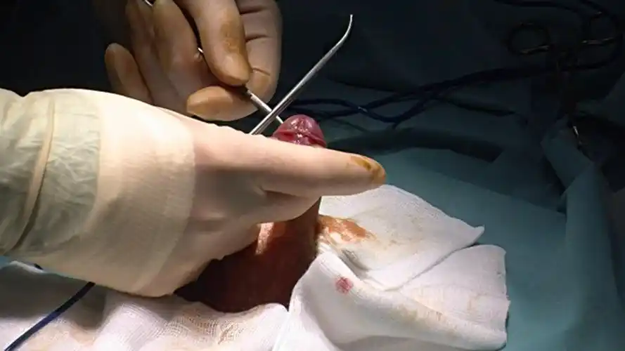 香港包皮过长医院_香港治疗包皮过长哪家医院好_香港