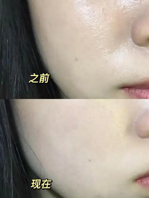 你们试过最牛逼最好用的控油水乳是什么