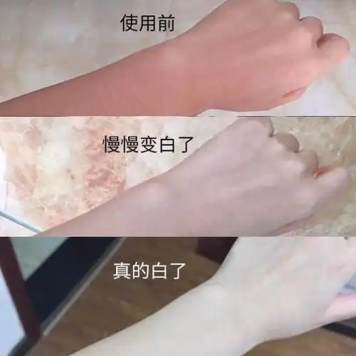 黑皮肤变白增白神器沐浴露全身脖子手臂脸部去却沐浴露