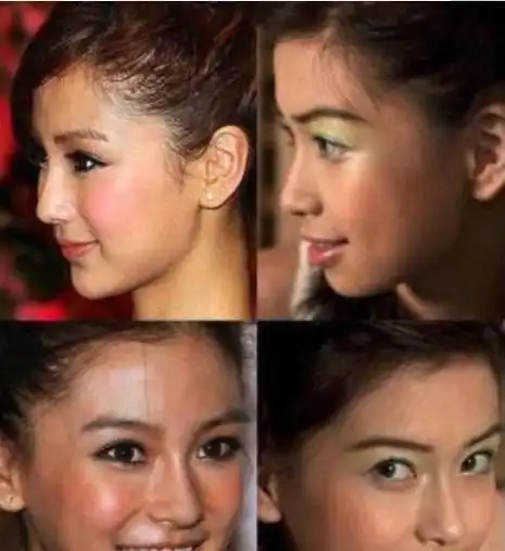 看起来杨颖好像去整牙了,效果真的挺明显的,差距这么大,观众都惊呆了!