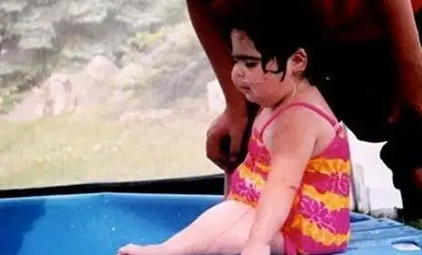 惊妈妈竟生下一个美人鱼人鱼宝宝双腿从胯部一直黏连至脚跟