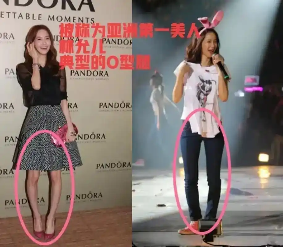 原来很多女明星腿型也不好看