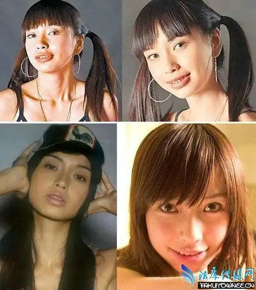 angelababy牙套时期雷人照片是怎么回事明星整牙前后对比照片