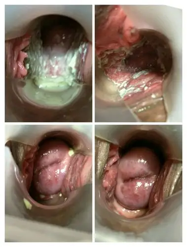 与性生活的和谐美满,王莎莎医生特推出免费检查妇科疾病项目能清楚让