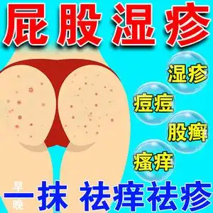 屁股湿疹股藓大腿内侧专用止痒肛门瘙痒宝宝湿疹皮肤疱疹抑菌药膏