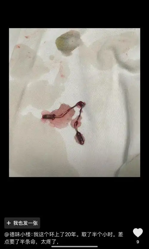 带妈妈去取环##妇产科迎来关停潮