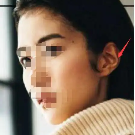 反骨真正位置图片,反骨是什么时候长的是先天还是后天?