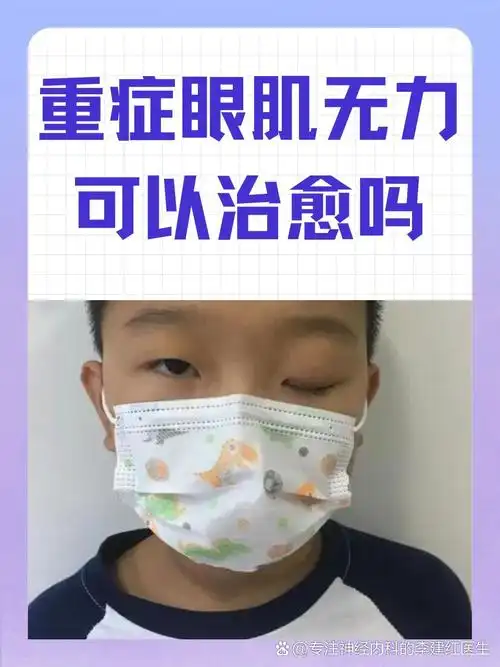 重症眼肌无力可以治愈吗